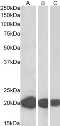 CSRP3 Antibody, Novus Biologicals 0.1mg; Unlabeled:Antibodies, Polyclonal